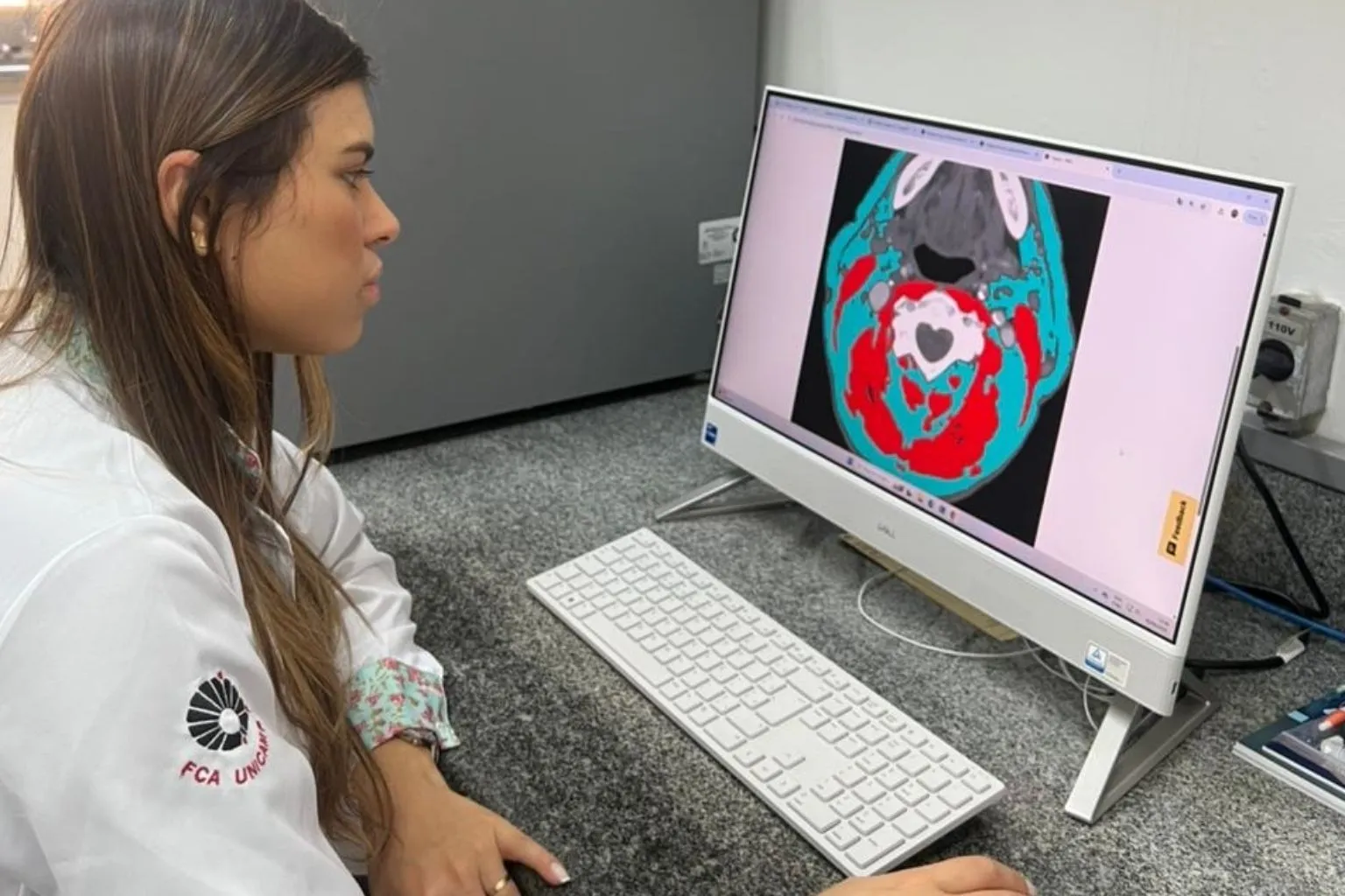 Descubra como a composição corporal, incluindo gordura e massa muscular, impacta a sobrevida em pacientes com câncer de cabeça e pescoço, segundo estudos brasileiros.