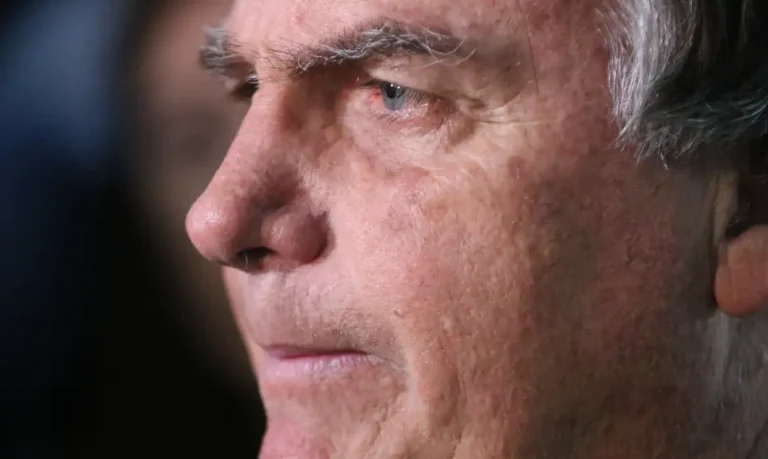 Bolsonaro é submetido a nova cirurgia para controlar crise persistente de soluços