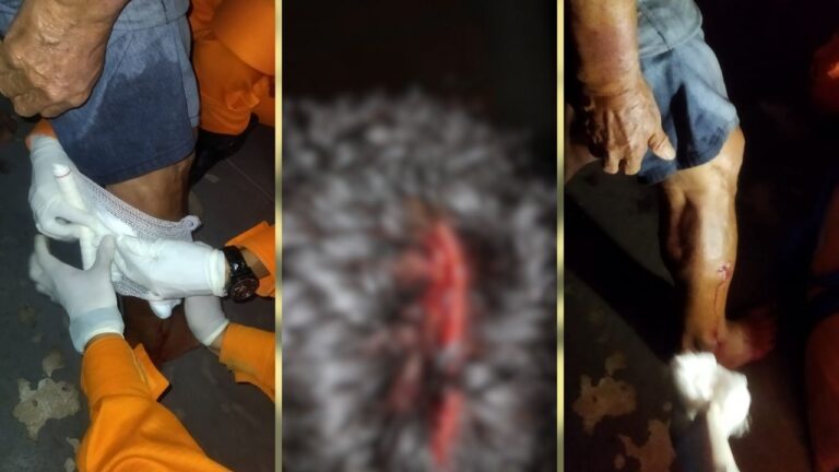 Idoso é atacado por pitbull no centro de Corumbá