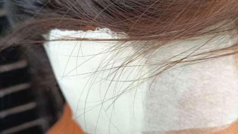 Mulher tem parte da orelha arrancada pelo companheiro na Aldeia Bororó