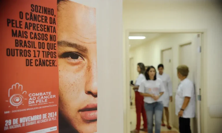 Câncer de pele registra alta de 4 mil para 72 mil casos em dez anos