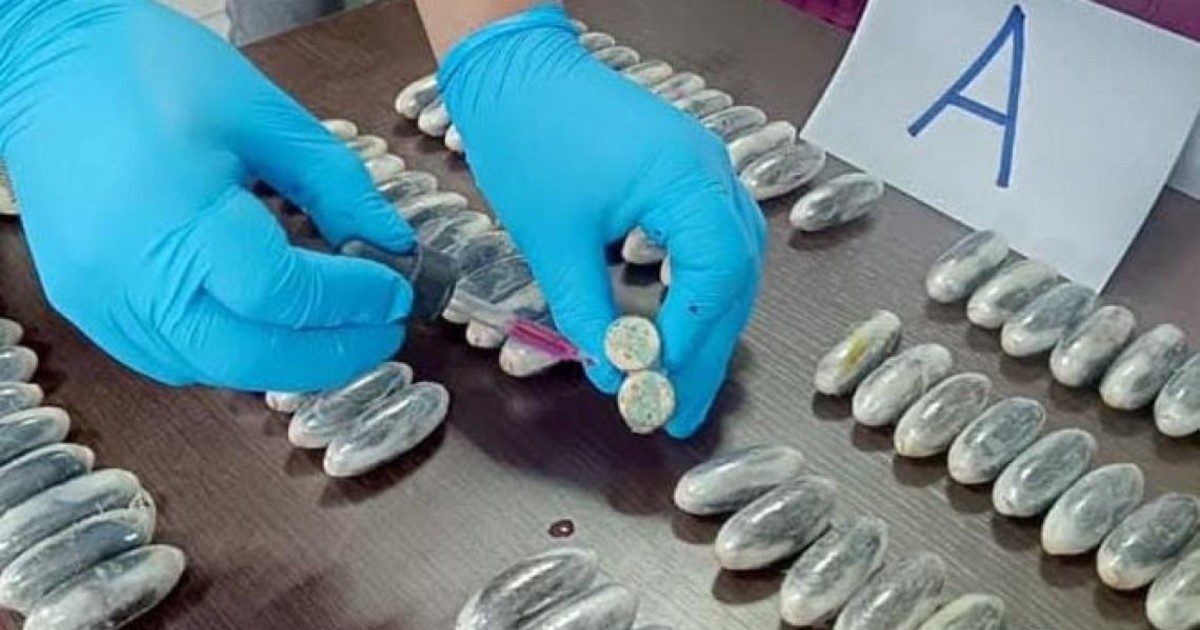Mão enluvada segurando cápsulas de cocaína após extração cirúrgica