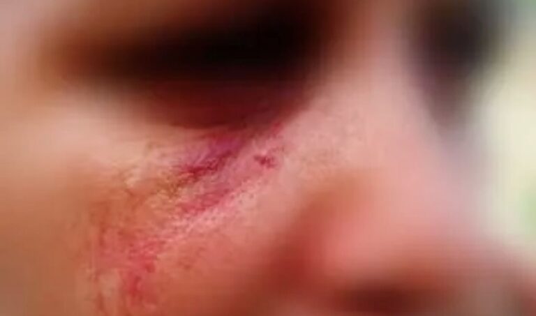 Mulher é resgatada de cárcere privado e agressões em Campo Grande