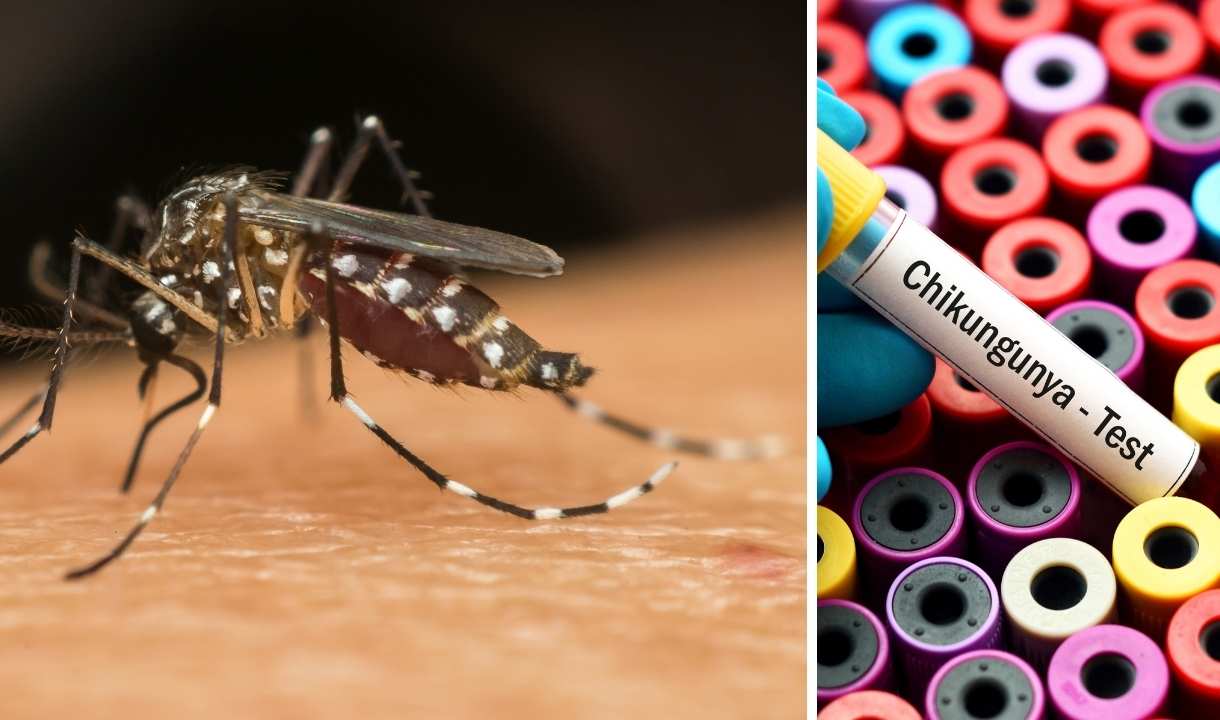 chikungunya