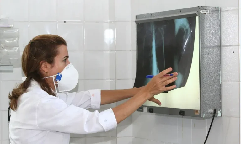 OMS propõe testes rápidos para tuberculose para ampliar diagnóstico e tratamento