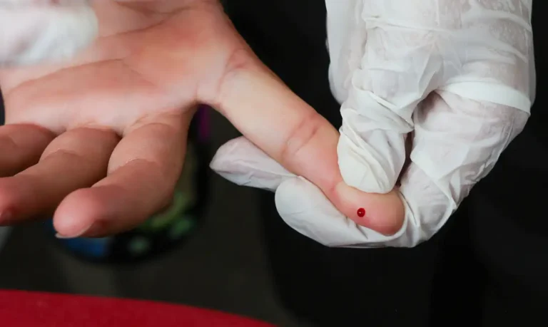 SUS amplia oferta e realiza teste rápido de dengue em unidades públicas