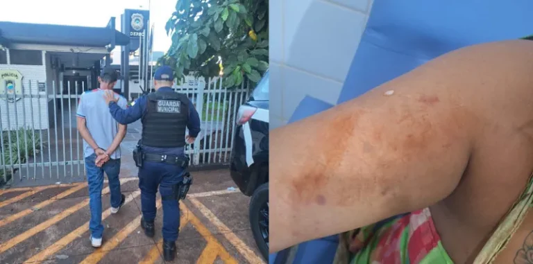 Mulher com curativo no braço chegando à delegacia enquanto é atendida por agentes da Guarda Municipal