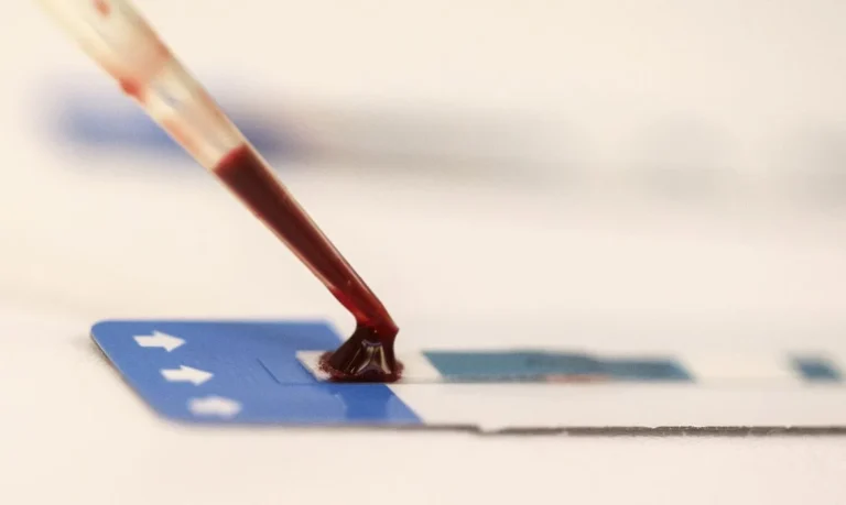 Fiocruz testa PrEP em estudo que busca ampliar prevenção de HIV entre jovens