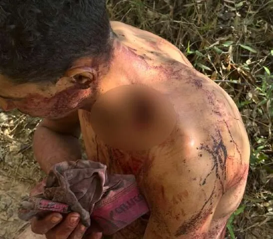 Policiais e bombeiros atendem homem às margens de um rio na zona rural