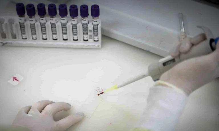 São Paulo investiga novo caso suspeito de ebola envolvendo brasileira retornada de Kivu