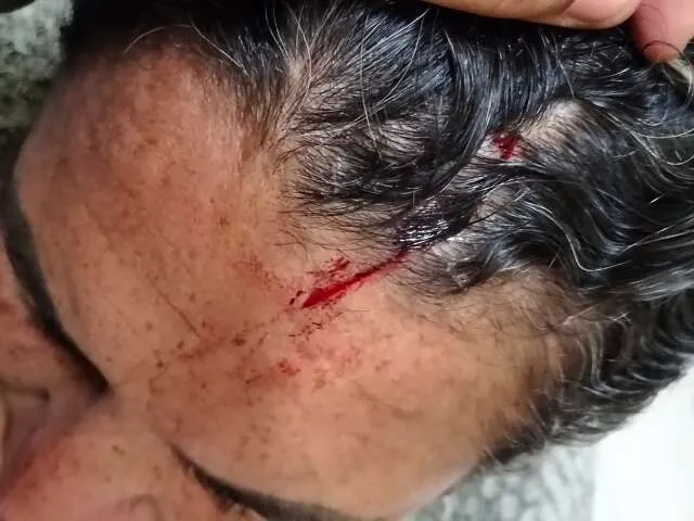 Rua noturna em Campo Grande com viatura policial, marcas de sangue e suspeito detido ao lado de facão apreendido