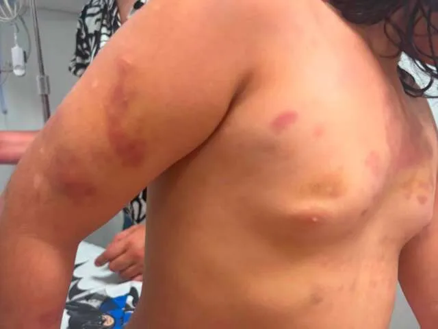 Corredor de hospital vazio com mochila infantil e fita de isolamento em frente a residência na fronteira