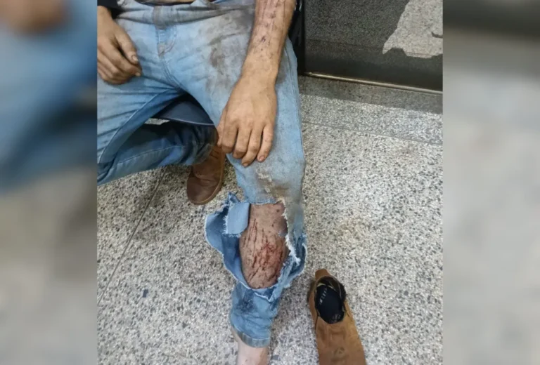 Jovem trabalhador rural com ferimentos após ataque de onça em Ponta Porã