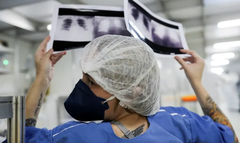 Diagnóstico tardio reduz chances de cura do câncer de pulmão no Brasil