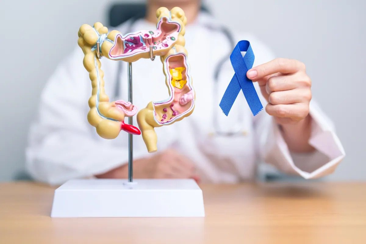 Ministério aprova diretrizes nacionais para rastrear câncer de intestino no SUS