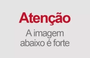 Leia mais sobre o artigo Em Ponta Porã homem tem mãos decepadas por desconhecidos