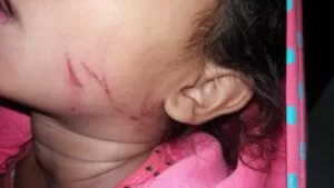 Leia mais sobre o artigo Criança de 3 anos tem fratura exposta após ser torturada por mãe e padrasto