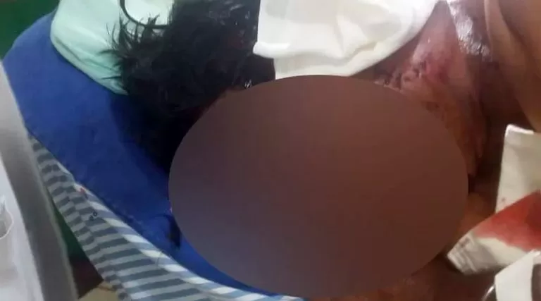 Peão passa por cirurgia após ser atacado por onça-pintada no Pantanal