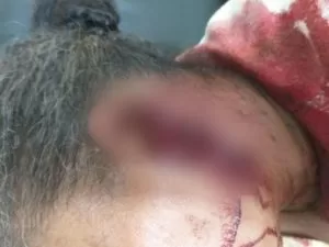 Leia mais sobre o artigo Homem é preso após cortar orelha de mulher com facão em MS