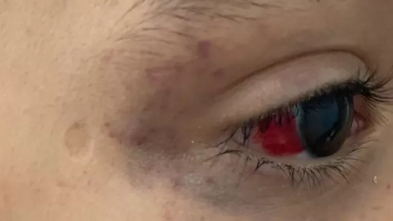 Criança é torturada com fio de celular por quase 24h após fazer xixi na cama em MS