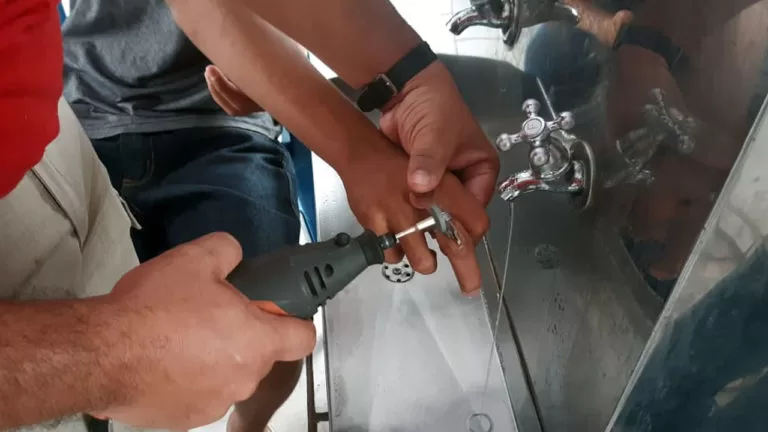 Jovem é socorrido pelos bombeiros ao ficar com anel preso ao dedo