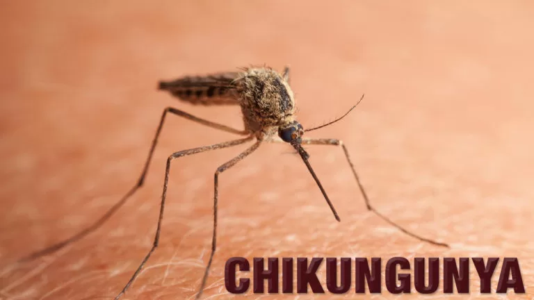 Chikungunya