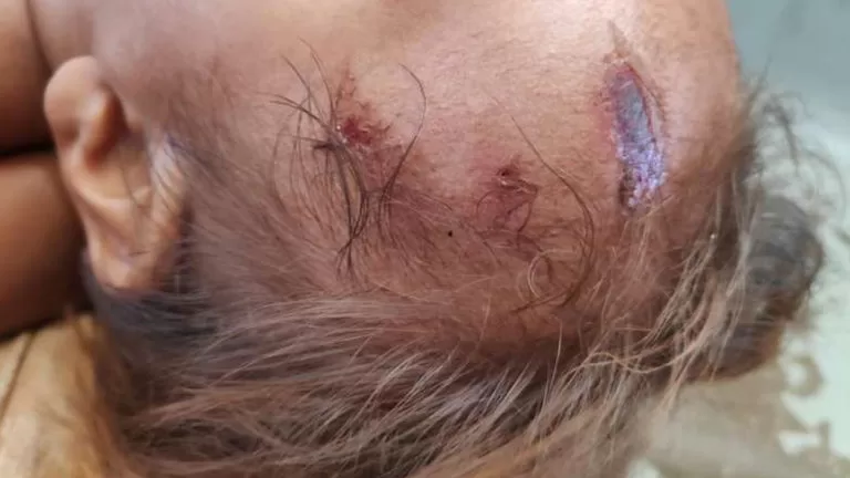 Pai atinge bebê de um ano e 4 meses com foice ao tentar agredir a companheira em MS