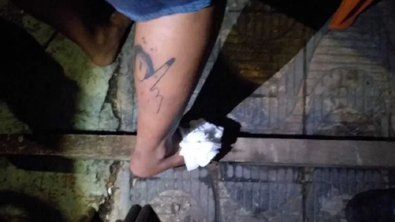 Jovem fica com vergalhão cravado no pé ao pular muro de casa no Aeroporto |Vídeo