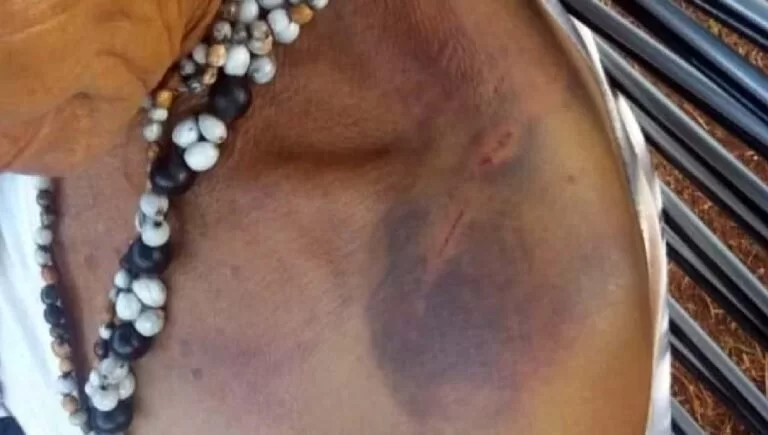 Indígenas denunciam ao MPF casos de tortura após escolha de novo líder em aldeia de MS