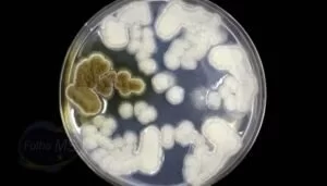 Leia mais sobre o artigo Saúde descarta suspeita de contaminação por “fungo negro” em paciente de Corumbá