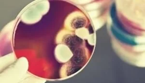 Leia mais sobre o artigo Paciente de Corumbá pode ser o segundo contaminado pelo “fungo negro” em MS