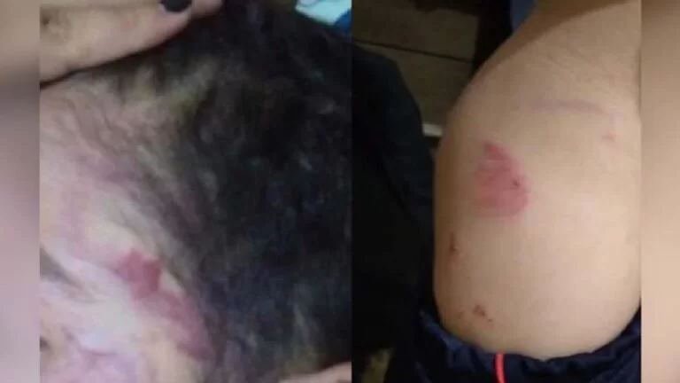 Homem é preso por espancar enteado de 5 anos em MS