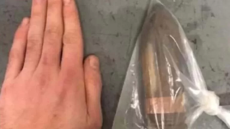 Hospital aciona equipe antibomba para receber homem com bala de canhão no reto