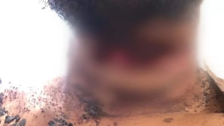 Homem é agredido e enterrado vivo por “colegas” de trabalho em MS