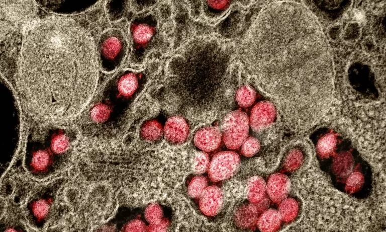 Ômicron: conheça os cinco sintomas da nova variante do coronavírus