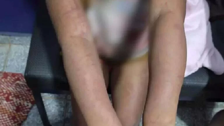 Mãe e padrasto são presos por torturar crianças de 4 e 6 anos em MS