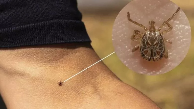 Aumenta para cinco o número de casos suspeitos de febre maculosa em MS