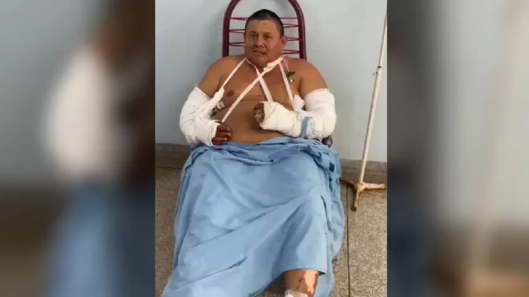 Amigo corajoso salvou vida de homem atacado por onça no Pantanal