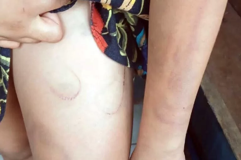 Mulher denuncia ex-companheiro por agressão e maus-tratos à filha autista em Coxim