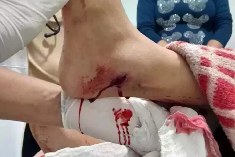 PM que atirou em criança durante abordagem é afastado das funções ostensivas