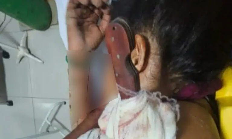 Mulher fica com faca cravada no ombro após tentativa de feminicídio em MS