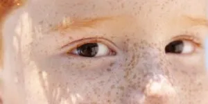 Leia mais sobre o artigo Reflexo branco nos olhos: entenda condição que assusta pais